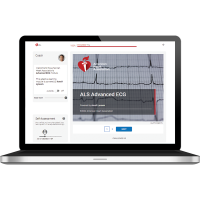 ALS: Advanced ECG Module